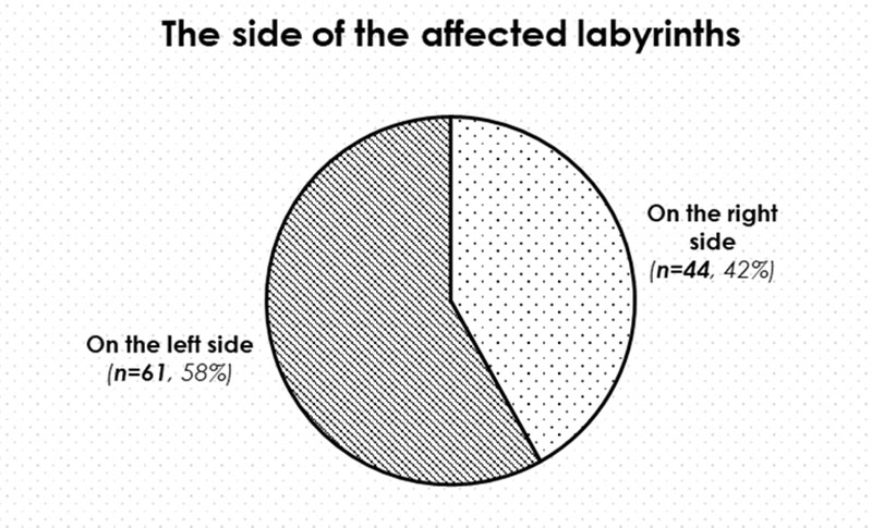 Labyrinth’s side affected in MD