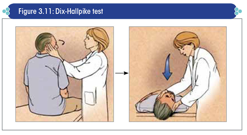 Dix-Hallpike test