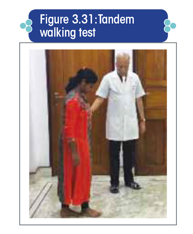 Tandem walking test