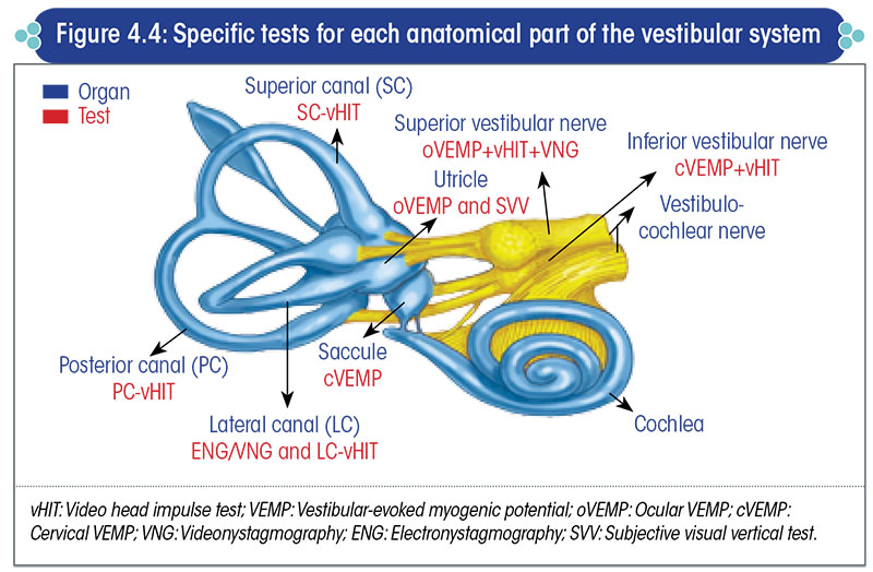 Specific tests for each anatomical part of the vestibular system