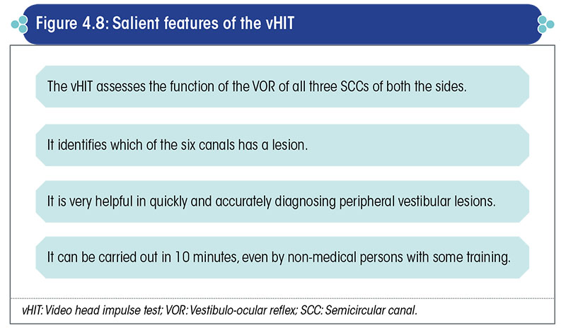 Salient features of the vHIT
