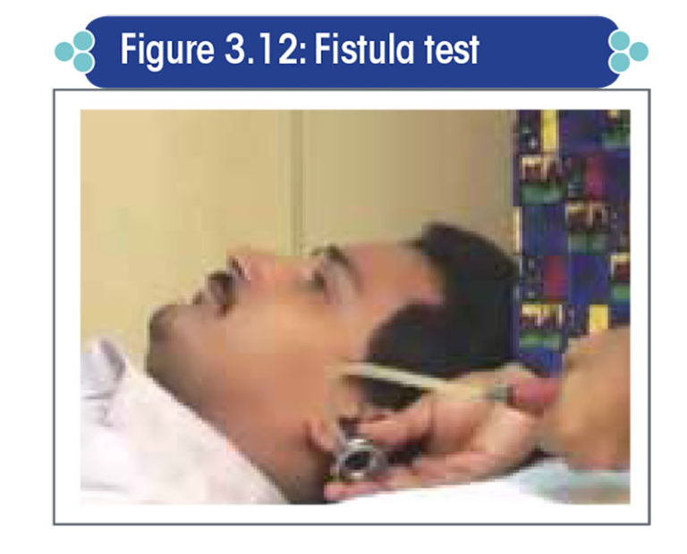 Evaluation of the vestibular system by clinical tests and by ...