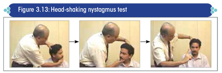 Evaluation of the vestibular system by clinical tests and by ...